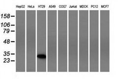 FHL1 Monoclonal Antibody (OTI1D6), TrueMAB , OriGene 100 &mu;L; Unconjugated:Antibodies,