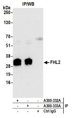 FHL2 Rabbit anti-Human, Polyclonal, Bethyl Laboratories 100 &mu;l; Unlabeled:Antibodies,