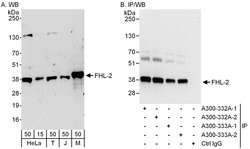 FHL2 Rabbit anti-Human, Mouse, Polyclonal, Bethyl Laboratories 100 μL;