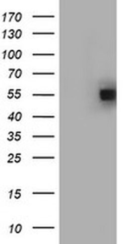 FICD Monoclonal Antibody (OTI15E10), TrueMAB , OriGene 100 &mu;L; Unconjugated:Antibodies,