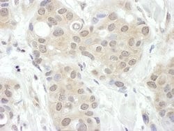 FIH-1 Rabbit anti-Human, Polyclonal, Bethyl Laboratories 100 &mu;L; Unconjugated:Antibodies,