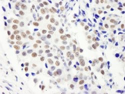 FIP1 Rabbit anti-Human, Polyclonal, Bethyl Laboratories 100 &mu;L; Unconjugated:Antibodies,