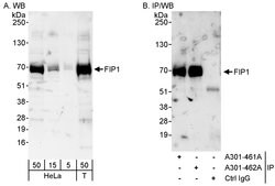 FIP1 Rabbit anti-Human, Polyclonal, Bethyl Laboratories 100 &mu;l; Unlabeled:Antibodies,