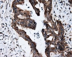 FKBP1A Mouse anti-Human, Clone: OTI3B3, lyophilized, TrueMAB 100 &mu;g;