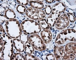 FKBP1A Mouse anti-Human, Clone: OTI3B3, lyophilized, TrueMAB 100 &mu;g;