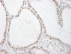 FKBP5/FKBP51 Rabbit anti-Human, Polyclonal, Bethyl Laboratories 100 &mu;L;