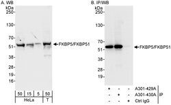 FKBP5/FKBP51 Rabbit anti-Human, Polyclonal, Bethyl Laboratories 100 &mu;L;