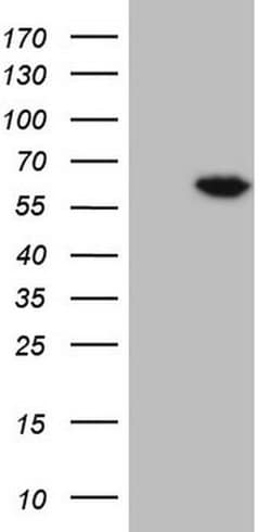 FLT1 Monoclonal Antibody (OTI11G5), TrueMAB , OriGene 30 &mu;L; Unconjugated:Antibodies,