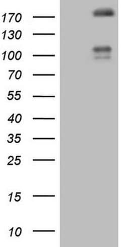 FLT4 Monoclonal Antibody (OTI1G2), TrueMAB , OriGene 100 &mu;L; Unconjugated:Antibodies,