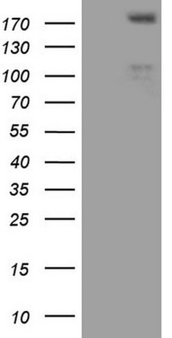 FLT4 Monoclonal Antibody (OTI1G7), TrueMAB , OriGene:Antibodies:Primary