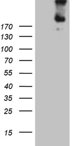 FLT4 Mouse anti-Human, Clone: OTI9G6, lyophilized, TrueMAB 100 &mu;g; Unconjugated:Antibodies,