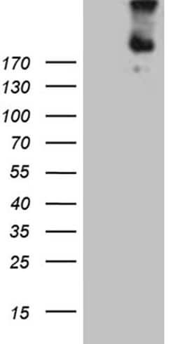 FLT4 Monoclonal Antibody (OTI9G6), TrueMAB , OriGene 100 &mu;L; Unconjugated:Antibodies,
