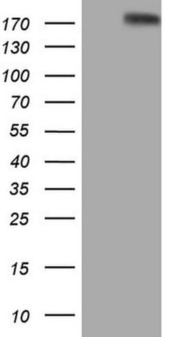 FLT4 Monoclonal Antibody (OTI8C2), TrueMAB , OriGene 100 &mu;L; Unconjugated:Antibodies,
