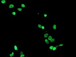 FMR1 Monoclonal Antibody (OTI5B9), TrueMAB , OriGene 100 &mu;L; Unconjugated:Antibodies,
