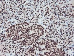 FMR1 Monoclonal Antibody (OTI5B9), TrueMAB , OriGene 100 &mu;L; Unconjugated:Antibodies,