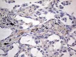 FN1 Monoclonal Antibody (OTI3F9), TrueMAB , OriGene 100 &mu;L; Unconjugated:Antibodies,