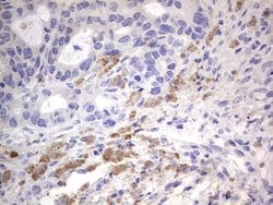 FN1 Monoclonal Antibody (OTI3F9), TrueMAB , OriGene:Antibodies:Primary