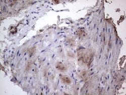 FN1 Monoclonal Antibody (OTI3F9), TrueMAB , OriGene 100 &mu;L; Unconjugated:Antibodies,