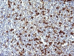 FNDC8 Monoclonal Antibody (OTI1C12), TrueMAB , OriGene 100 &mu;L; Unconjugated:Antibodies,