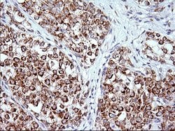 FNDC8 Monoclonal Antibody (OTI1C12), TrueMAB , OriGene 100 &mu;L; Unconjugated:Antibodies,
