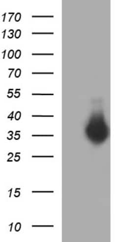 FNDC8 Mouse anti-Human, Clone: OTI1F4, lyophilized, TrueMAB 100 &mu;g;