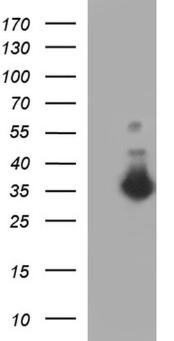FNDC8 Monoclonal Antibody (OTI1C10), TrueMAB , OriGene 30 &mu;L | Buy Online | Origene Technologies | Fisher Scientific