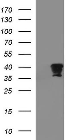 FNDC8 Monoclonal Antibody (OTI1C12), TrueMAB , OriGene 100 &mu;L; Unconjugated:Antibodies,