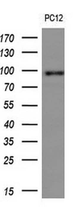 FOLH1 Monoclonal Antibody (OTI5A9), TrueMAB , OriGene 100 &mu;L; Unconjugated:Antibodies,