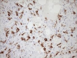 FOLR2 Mouse anti-Human, Clone: OTI8G1, lyophilized, TrueMAB 100 &mu;g;