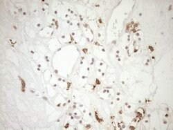 FOLR2 Monoclonal Antibody (OTI5B1), TrueMAB , OriGene 100 &mu;L; Unconjugated:Antibodies,