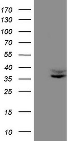 FOLR2 Monoclonal Antibody (OTI5B1), TrueMAB , OriGene 100 &mu;L; Unconjugated:Antibodies,
