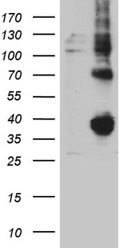 FOLR3 Mouse anti-Human, Clone: OTI7E10, liquid, TrueMAB 100 &mu;L; Unconjugated:Antibodies,
