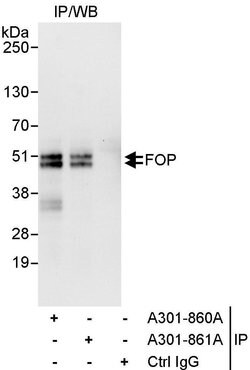 FOP Rabbit anti-Human, Polyclonal, Bethyl Laboratories 10 &mu;L; Unconjugated:Antibodies,