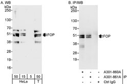 FOP Rabbit anti-Human, Polyclonal, Bethyl Laboratories 100 &mu;L; Unconjugated:Antibodies,