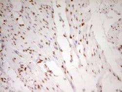 FOS Monoclonal Antibody (OTI2D2), TrueMAB , OriGene 100 &mu;L; Unconjugated:Antibodies,