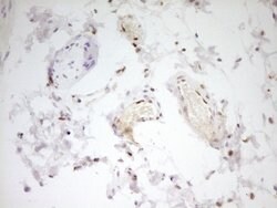 FOS Monoclonal Antibody (OTI2D2), TrueMAB , OriGene 100 &mu;L; Unconjugated:Antibodies,