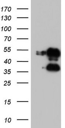 FOSB Monoclonal Antibody (OTI2A1), TrueMAB , OriGene:Antibodies:Primary