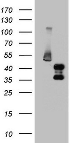 FOSB Mouse anti-Human, Clone: OTI5H5, lyophilized, TrueMAB 100 &mu;g; Unconjugated:Antibodies,
