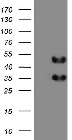 FOSB Mouse anti-Human, Clone: OTI6H6, lyophilized, TrueMAB 100 &mu;g; Unconjugated:Antibodies,