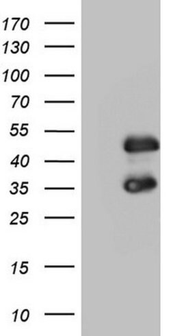 FOSB Monoclonal Antibody (OTI1A7), TrueMAB , OriGene 100 &mu;L; Unconjugated:Antibodies,