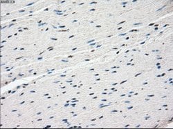 FOSL1 Mouse anti-Human, Clone: OTI12F9, lyophilized, TrueMAB 100 &mu;g;