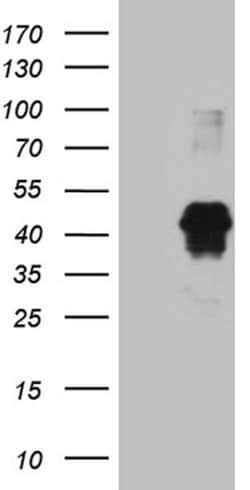 FOSL2 Monoclonal Antibody (OTI1G1), TrueMAB , OriGene 100 &mu;L; Unconjugated:Antibodies,