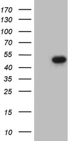 FOSL2 Mouse anti-Human, Clone: OTI2B4, lyophilized, TrueMAB 100 &mu;g | Buy Online | OriGene | Fisher Scientific