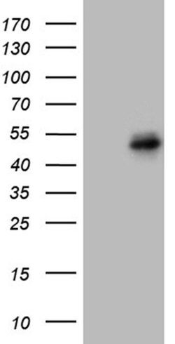 FOSL2 Monoclonal Antibody (OTI1G2), TrueMAB , OriGene 30 &mu;L | Buy Online | Origene Technologies | Fisher Scientific