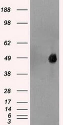 FOXA1 Mouse anti-Canine, Human, Clone: OTI3C1, liquid, TrueMAB 100 &mu;L;