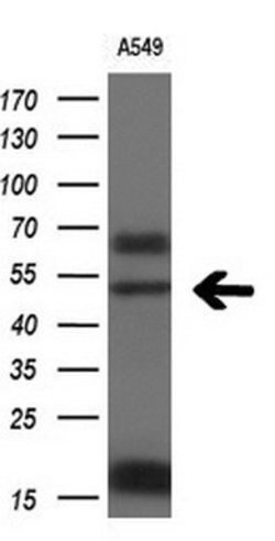 FOXA2 Mouse anti-Human, Clone: OTI3C10, lyophilized, TrueMAB 100 &mu;g;