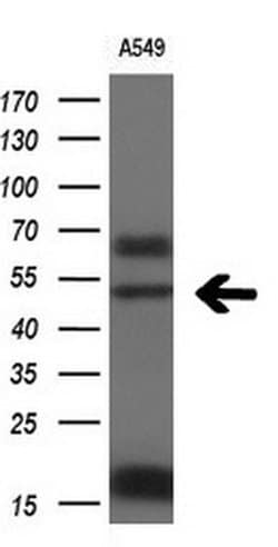 FOXA2 Mouse anti-Human, Clone: OTI3C10, liquid, TrueMAB 100 &mu;L; Unconjugated:Antibodies,