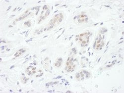FOXC1 Rabbit anti-Human, Polyclonal, Bethyl Laboratories 100 &mu;L; Unconjugated:Antibodies,