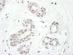 FOXC1 Rabbit anti-Human, Polyclonal, Bethyl Laboratories 100 &mu;L; Unconjugated:Antibodies,