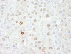 FOXK1 Polyclonal Antibody, Bethyl Laboratories 10 &mu;L; Unconjugated:Antibodies,
